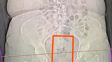 Erzincan'da Uyuşturucu Operasyonu: 4 Gözaltı